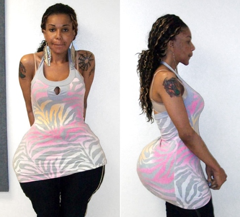 Fix-A-Flat-butt-injection